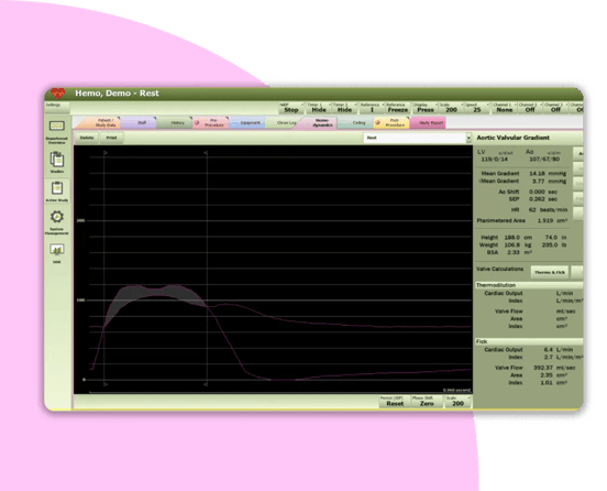 IMG-Merge-Web-Comprehensive-hemodynamic-capabilities-1104x552