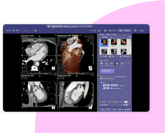 SCR-Merge-Cardio-CVIS-007-1125x912